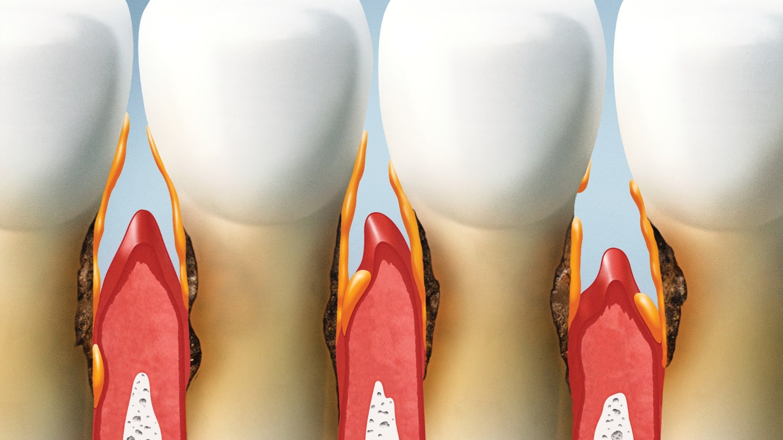 periodontal treatment richmond